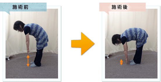 施術前と施術後の変化